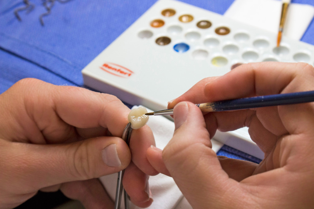 Iverson Dental Labs Best Dental Lab Products and Services