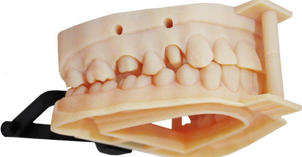 3d printed dental model