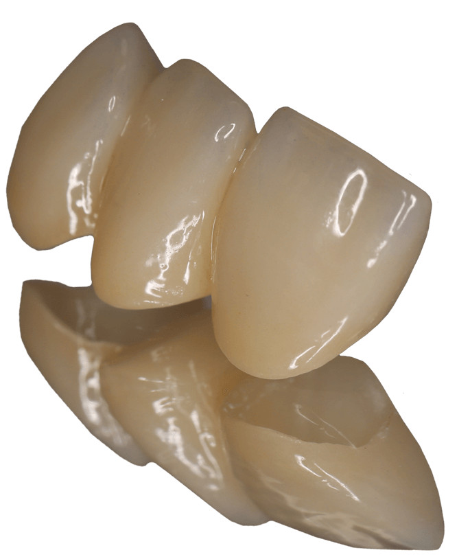 best dental lab natzral plus 3 unit Crown and Bridge full contour zirconia