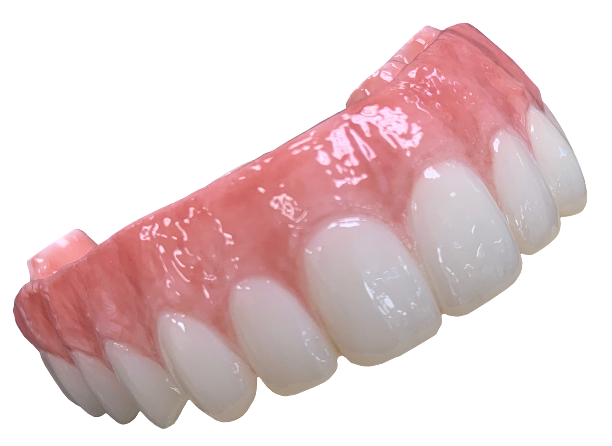 Implant Denture dental lab