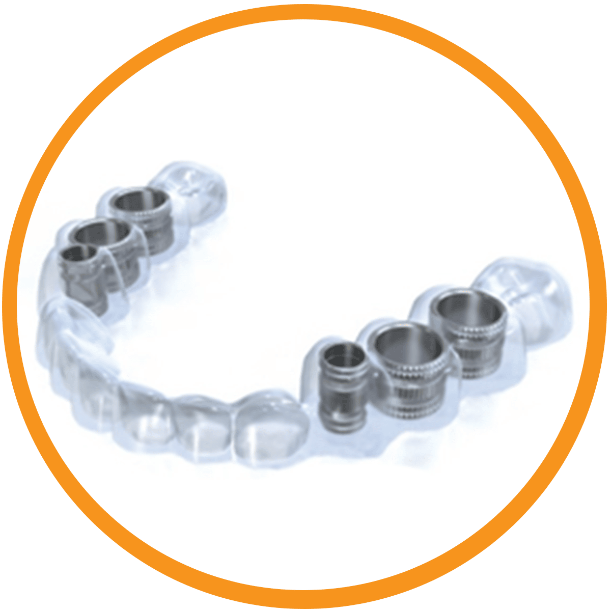 accuguide surgical guide for dental implant placement